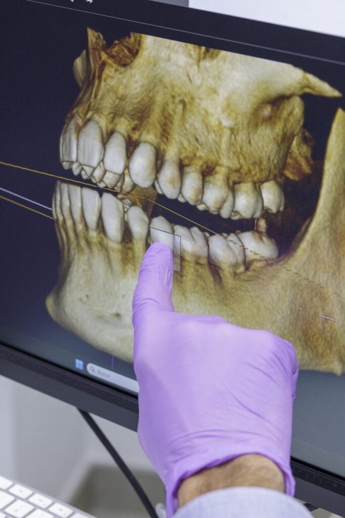 Planificación con TAC 3D