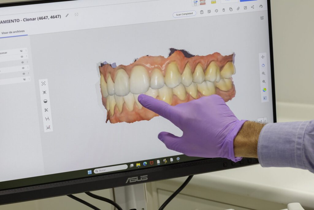 Planificación digital de la sonrisa en 3D