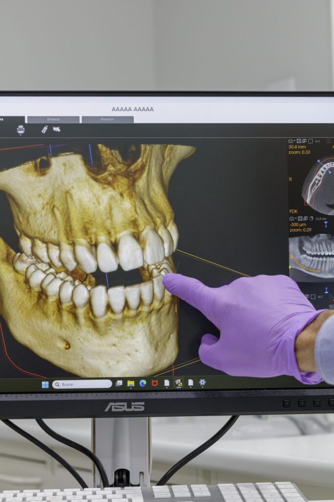 Planificación con TAC 3D (CBCT)